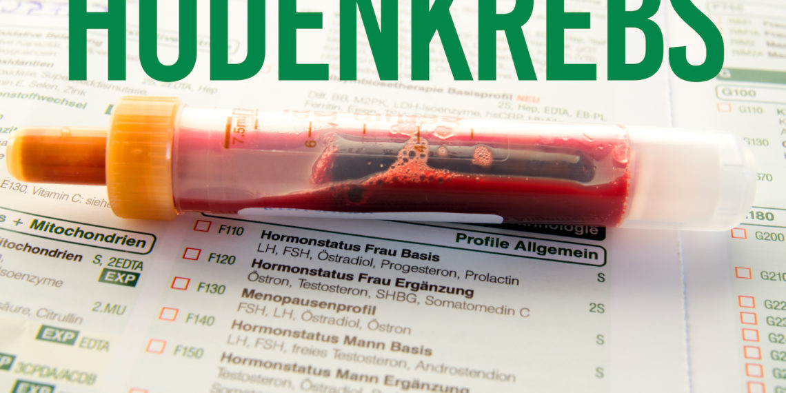 Hodenkrebs Symptome Ursachen Behandlung Heilpraxis