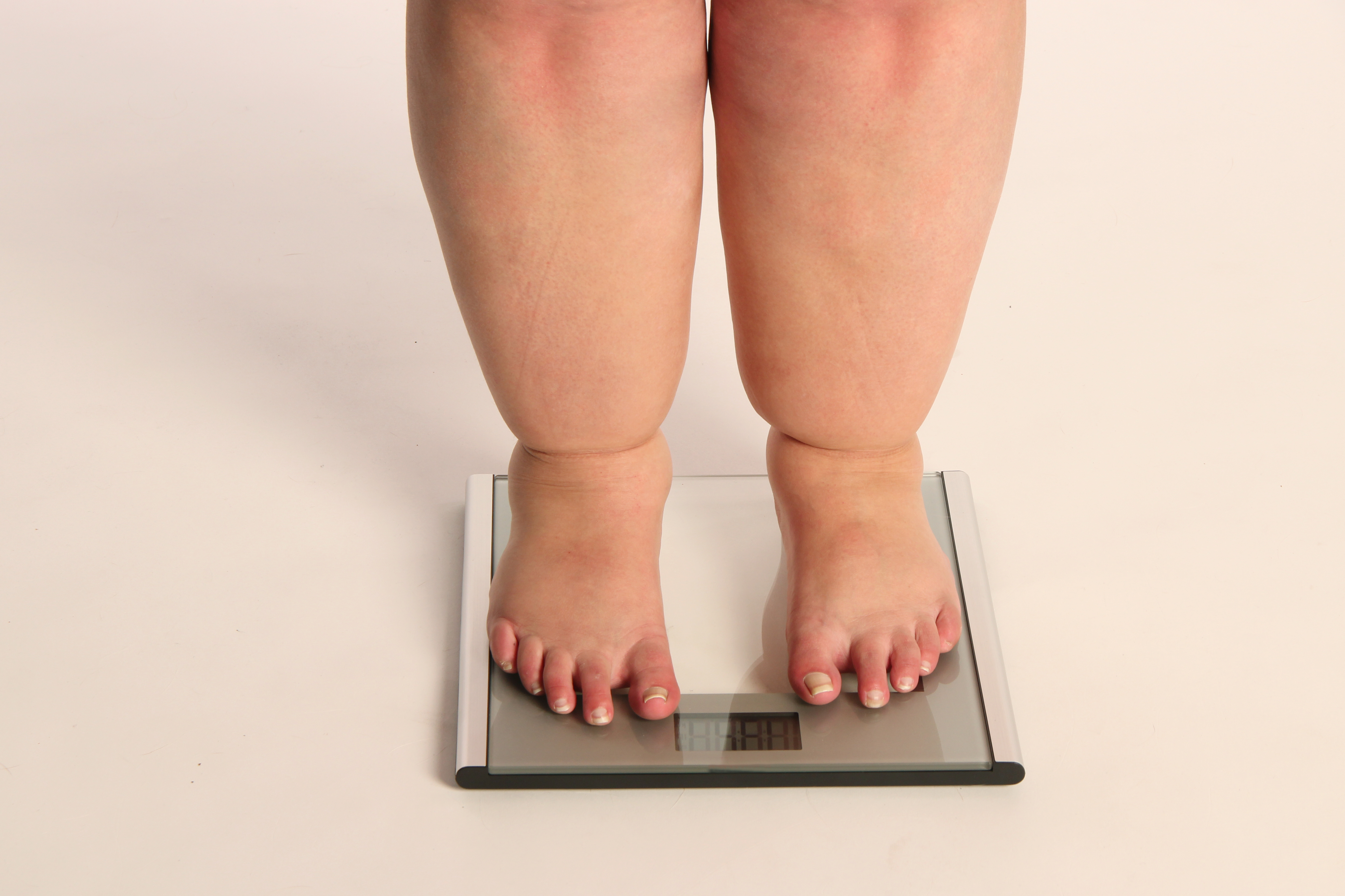 Отеки и лишний вес