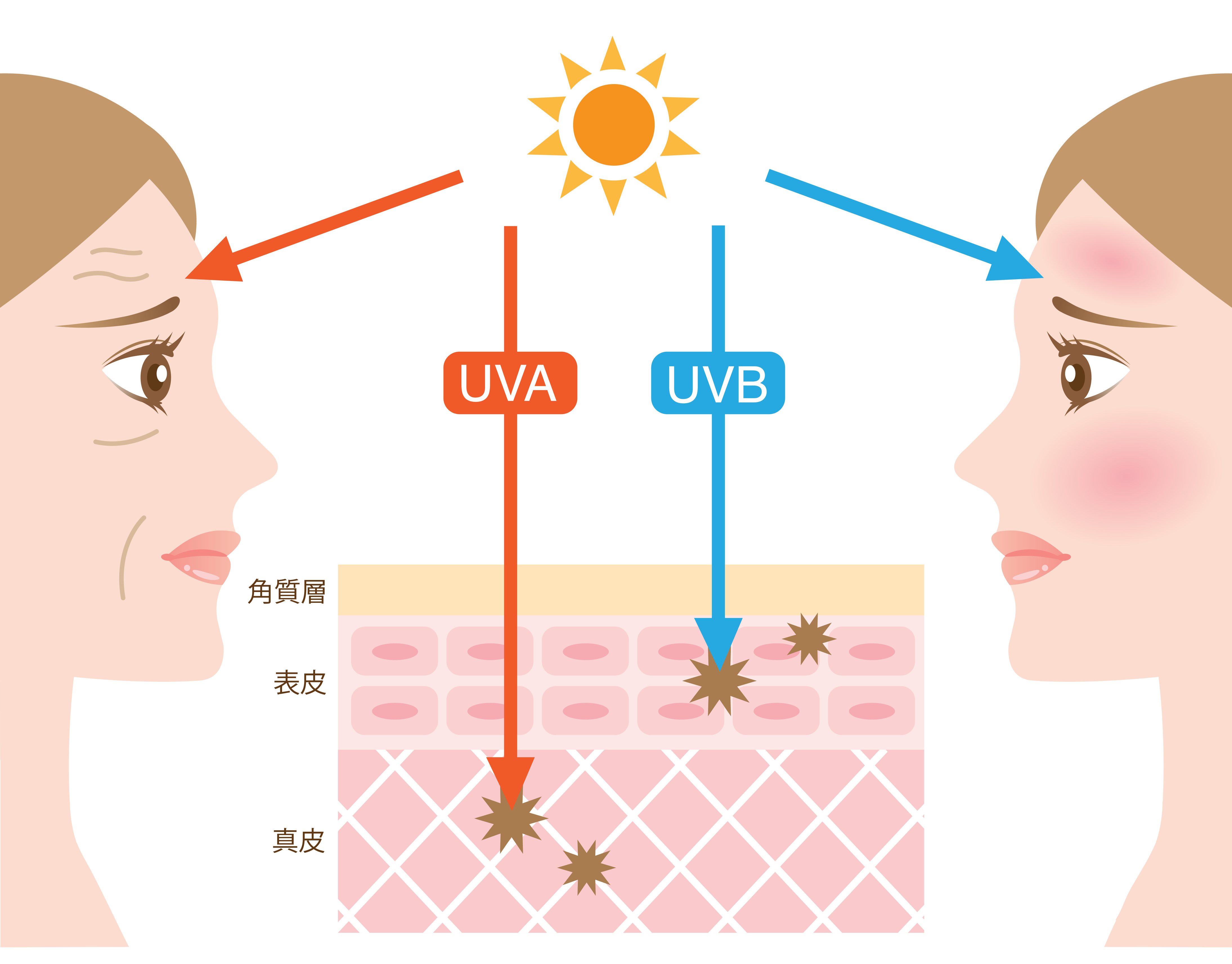 Почему образуется загар. Лучи ультрафиолетовые UVA UVB. UVA UVB лучи схема. UVA UVB лучи что это. Воздействие УФ лучей на кожу.