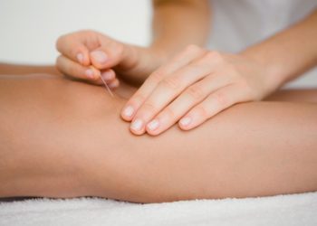 In der Naturheilkunde findet oftmals die Akupunktur Anwendung bei Flüssigkeitsansammlungen im Knie. (Bild: WavebreakmediaMicro/fotolia.com)