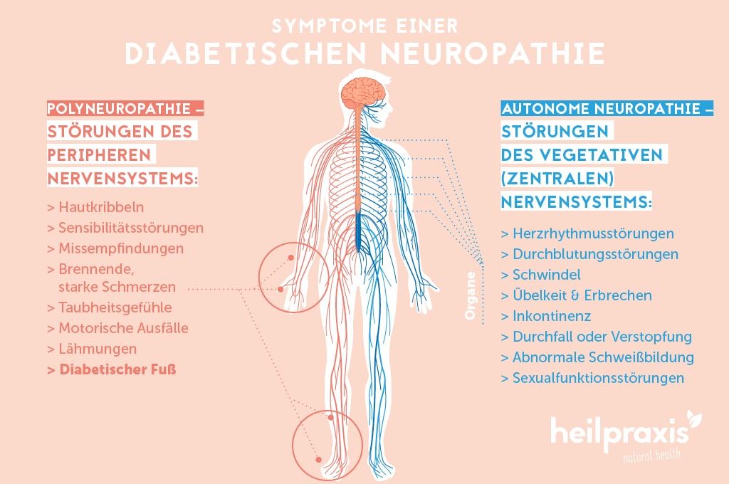 Diabetes mellitus mit Polyneuropathie: Ein komplexes Krankheitsbild