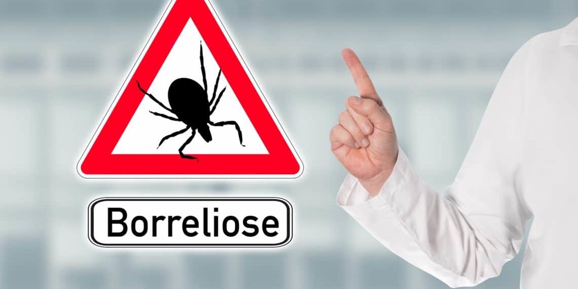 Borreliose Symptome Behandlung Und Verlauf Heilpraxis 0107