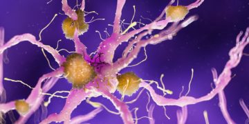 Alzheimer-Krankheit: Neue Therapie soll Demenz ausbremsen ...