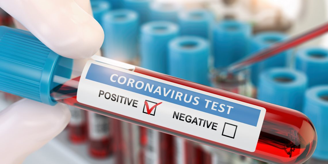 Bild Corona Test Positiv: Unveiling the Value and Urgency for Your Health