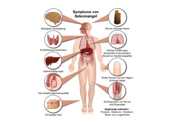 Ein Schaubild über Beschwerden, die bei einem Mangel an Selen auftreten können.