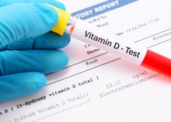 Hand mit blauem Handschuh hält ein mit Vitamin D-Test beschriftetes Probenröhrchen über ein Blatt mit Daten einer Analyse von Vitamin D im Blut