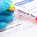 Hand mit blauem Handschuh hält ein mit Vitamin D-Test beschriftetes Probenröhrchen über ein Blatt mit Daten einer Analyse von Vitamin D im Blut