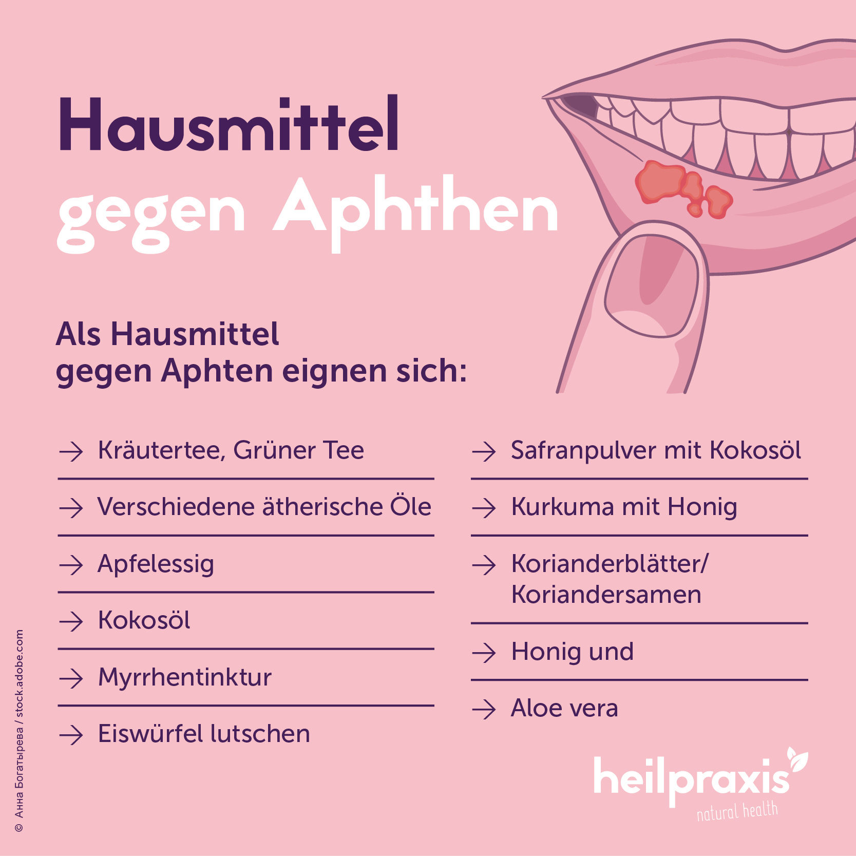 Infografik Hausmittel gegen Aphthen